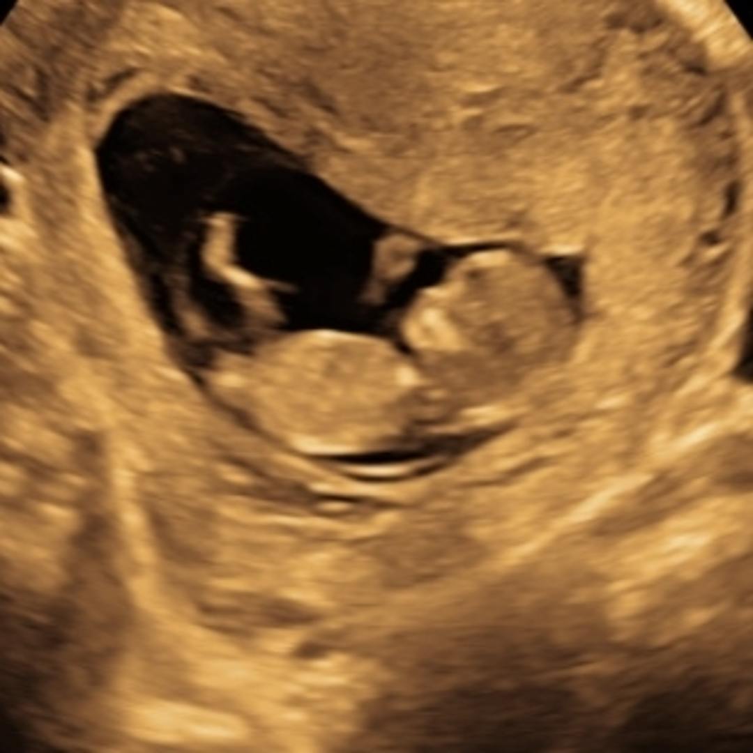 Photo shared by Courtney for their Babylist baby registry.