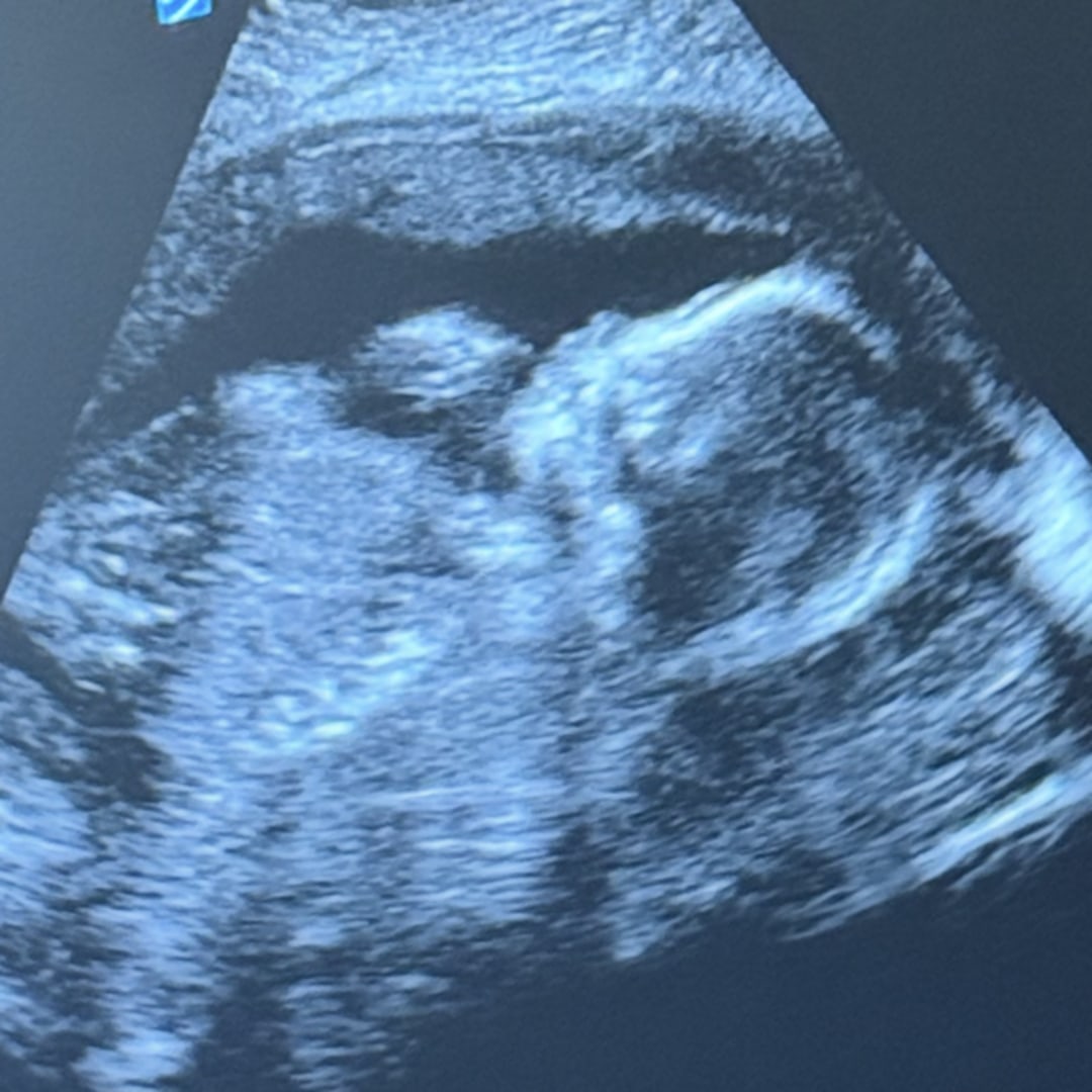 Photo shared by Aracelia for their Babylist baby registry.
