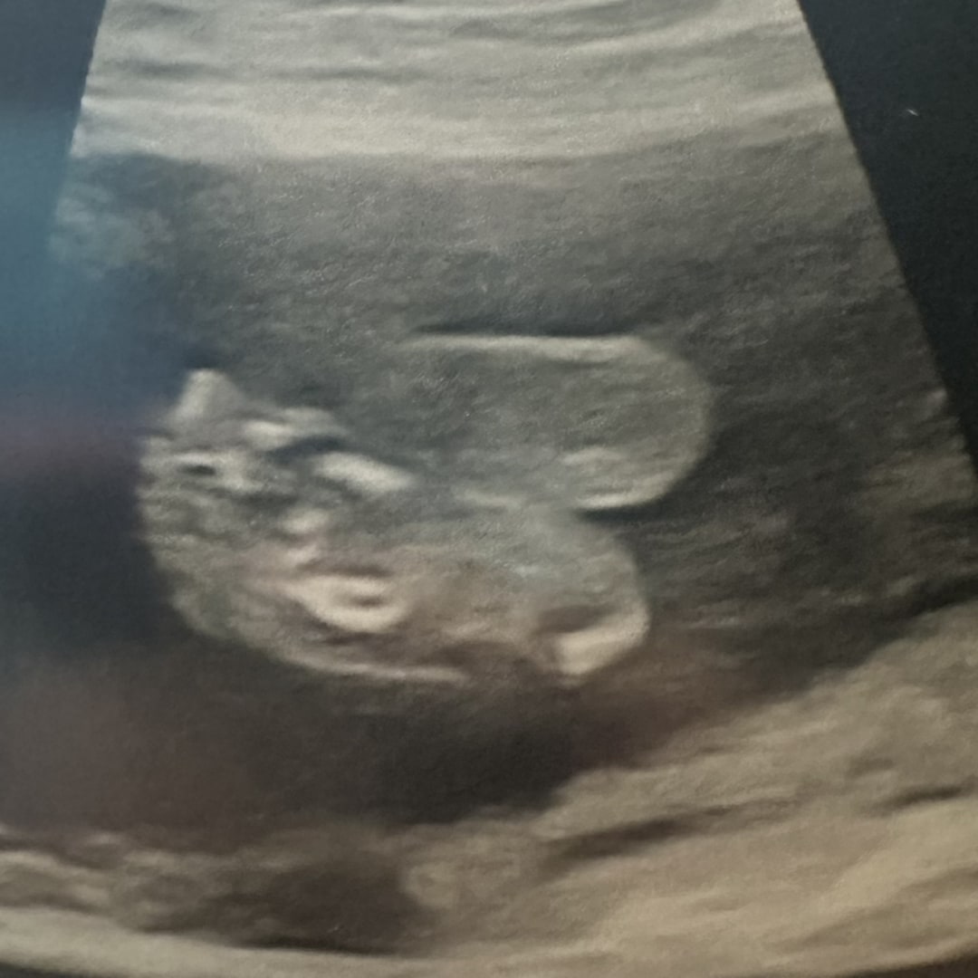 Photo shared by Colleen for their Babylist baby registry.