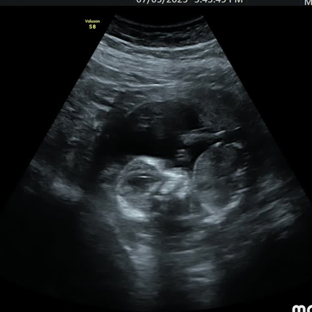 Photo shared by Logan for their Babylist baby registry.