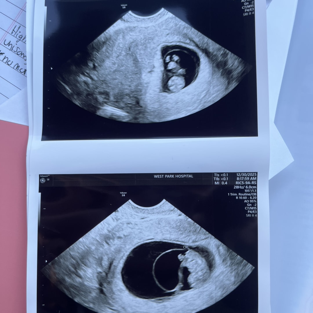 Photo shared by Tessa for their Babylist baby registry.