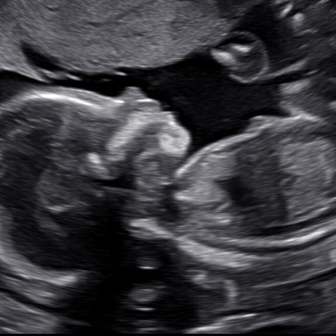 Photo shared by Jessica for their Babylist baby registry.
