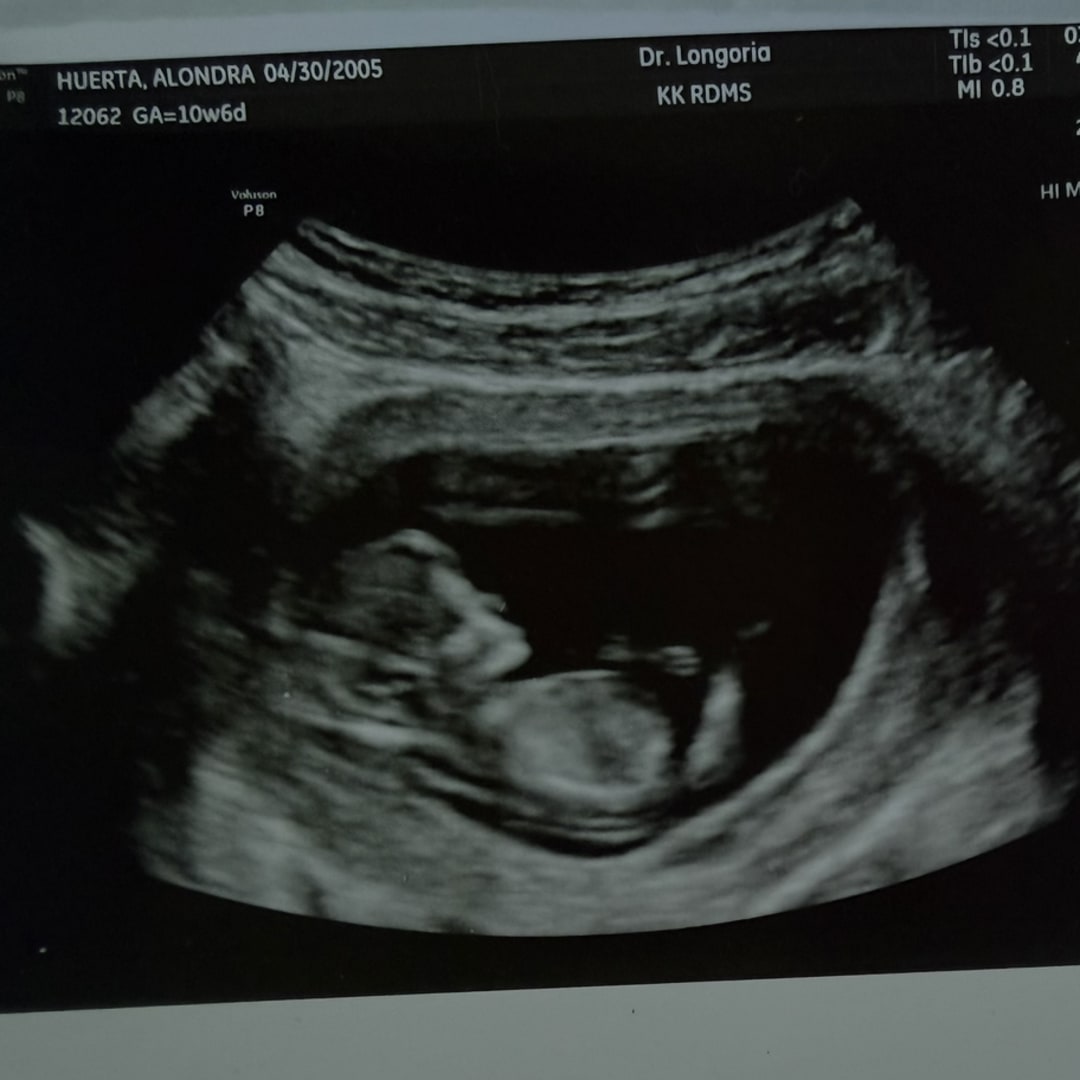 Photo shared by Alondra for their Babylist baby registry.