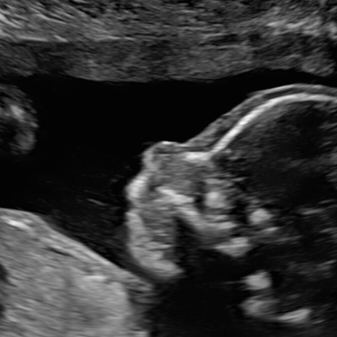 Photo shared by Cassidy for their Babylist baby registry.