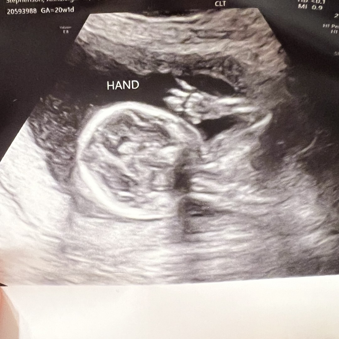 Photo shared by Annaleigh for their Babylist baby registry.