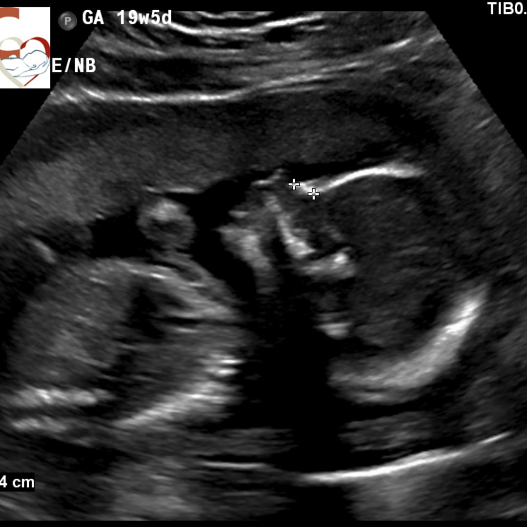 Photo shared by Meghan for their Babylist baby registry.