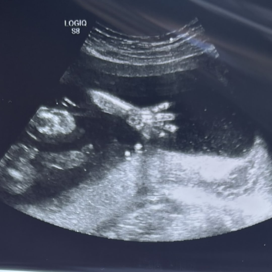 Photo shared by Carys for their Babylist baby registry.