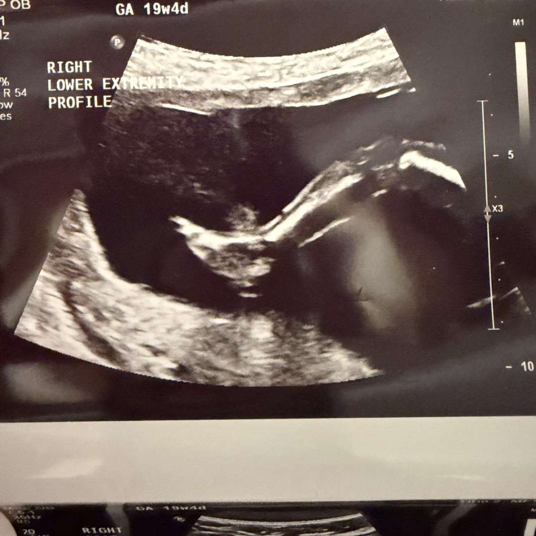 Photo shared by Ashley for their Babylist baby registry.