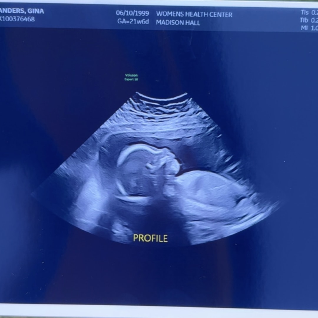 Photo shared by Gina for their Babylist baby registry.
