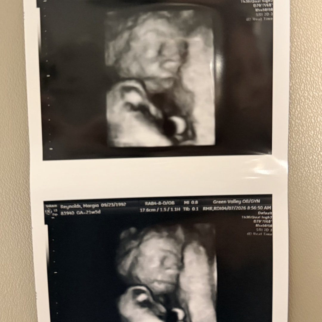 Photo shared by Kathleen for their Babylist baby registry.