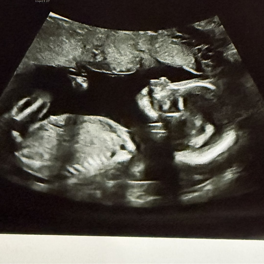 Photo shared by Angela for their Babylist baby registry.