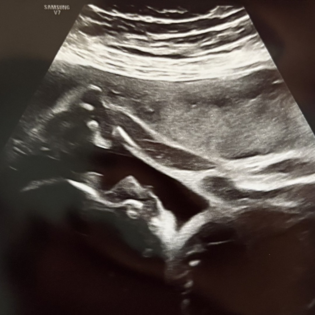 Photo shared by Halle for their Babylist baby registry.