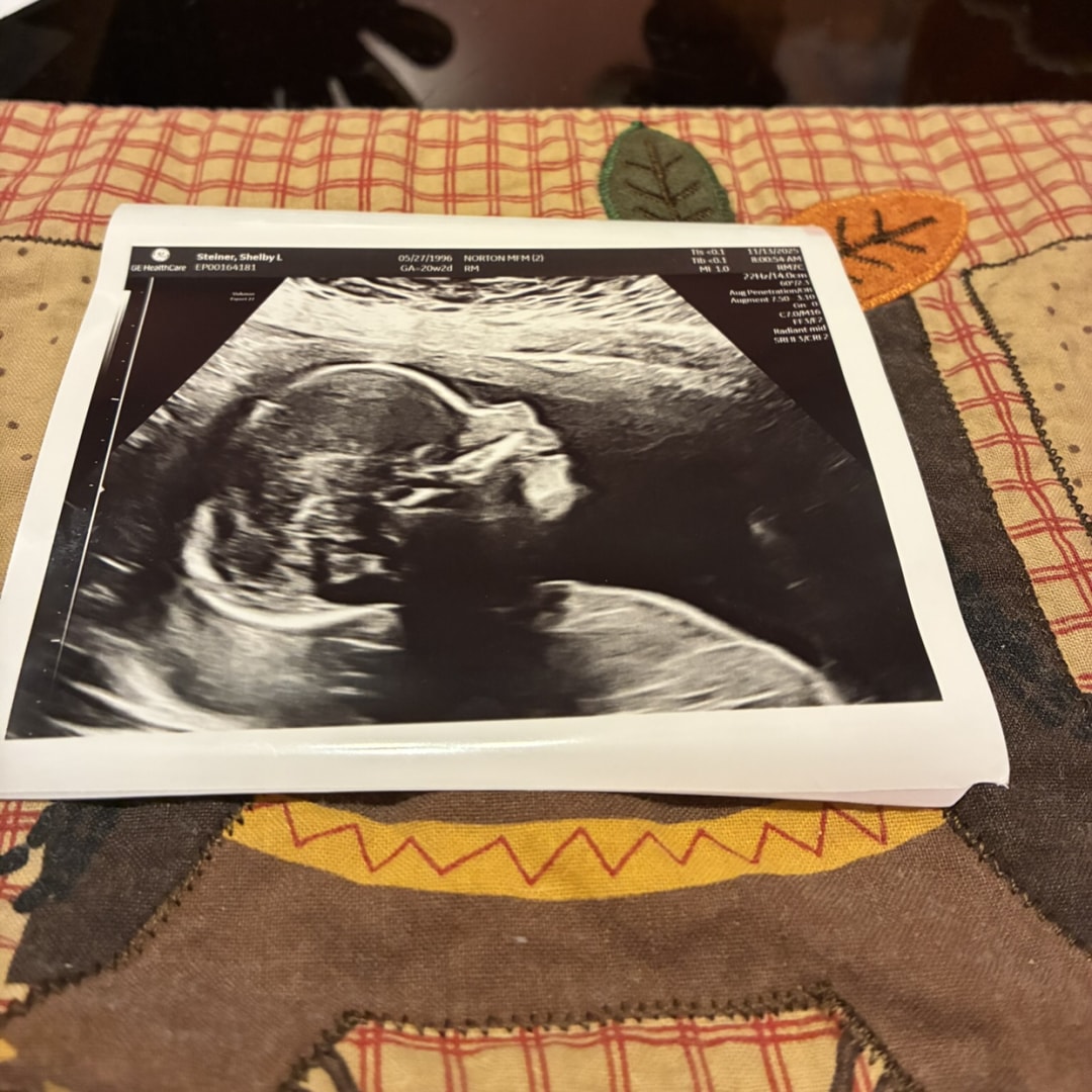 Photo shared by Shelby for their Babylist baby registry.