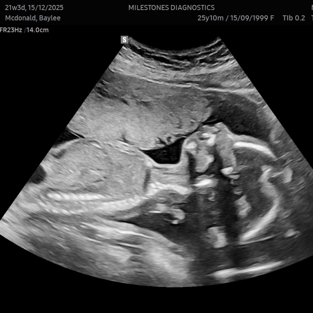 Photo shared by Baylee for their Babylist baby registry.