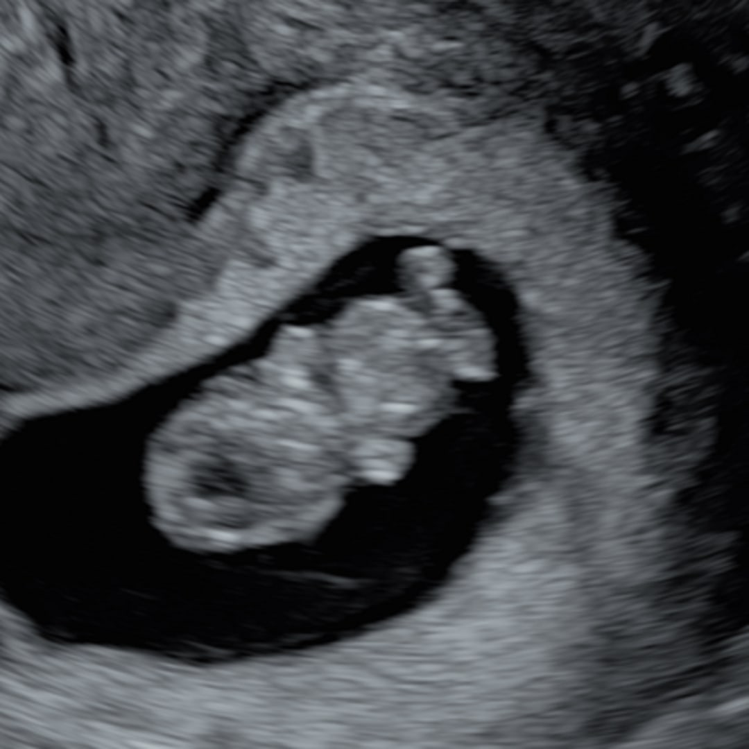Photo shared by Aileen for their Babylist baby registry.