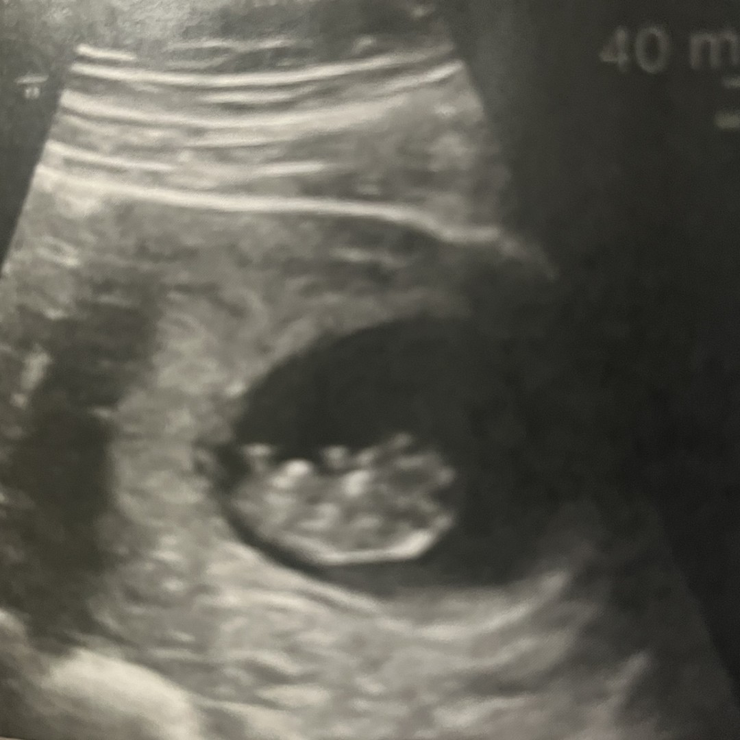 Photo shared by Bridgette+ for their Babylist baby registry.