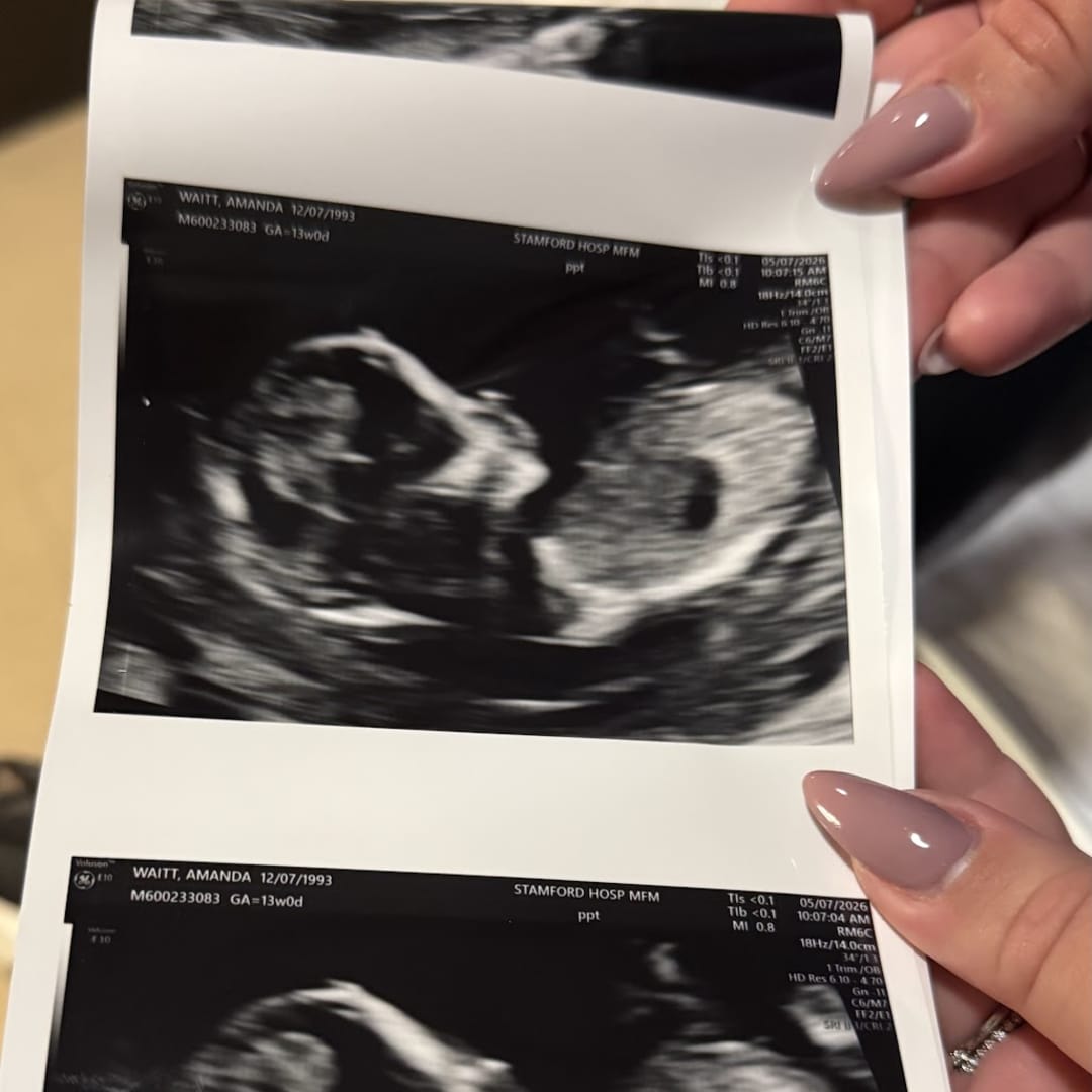 Photo shared by Amanda for their Babylist baby registry.