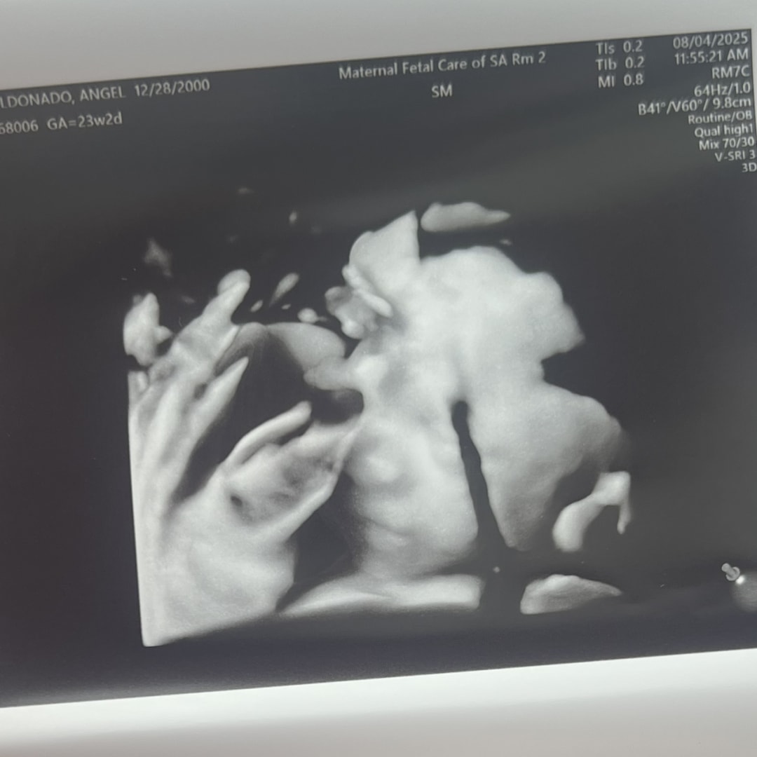 Photo shared by Angel for their Babylist baby registry.
