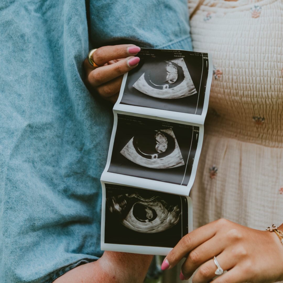 Photo shared by Lillian for their Babylist baby registry.