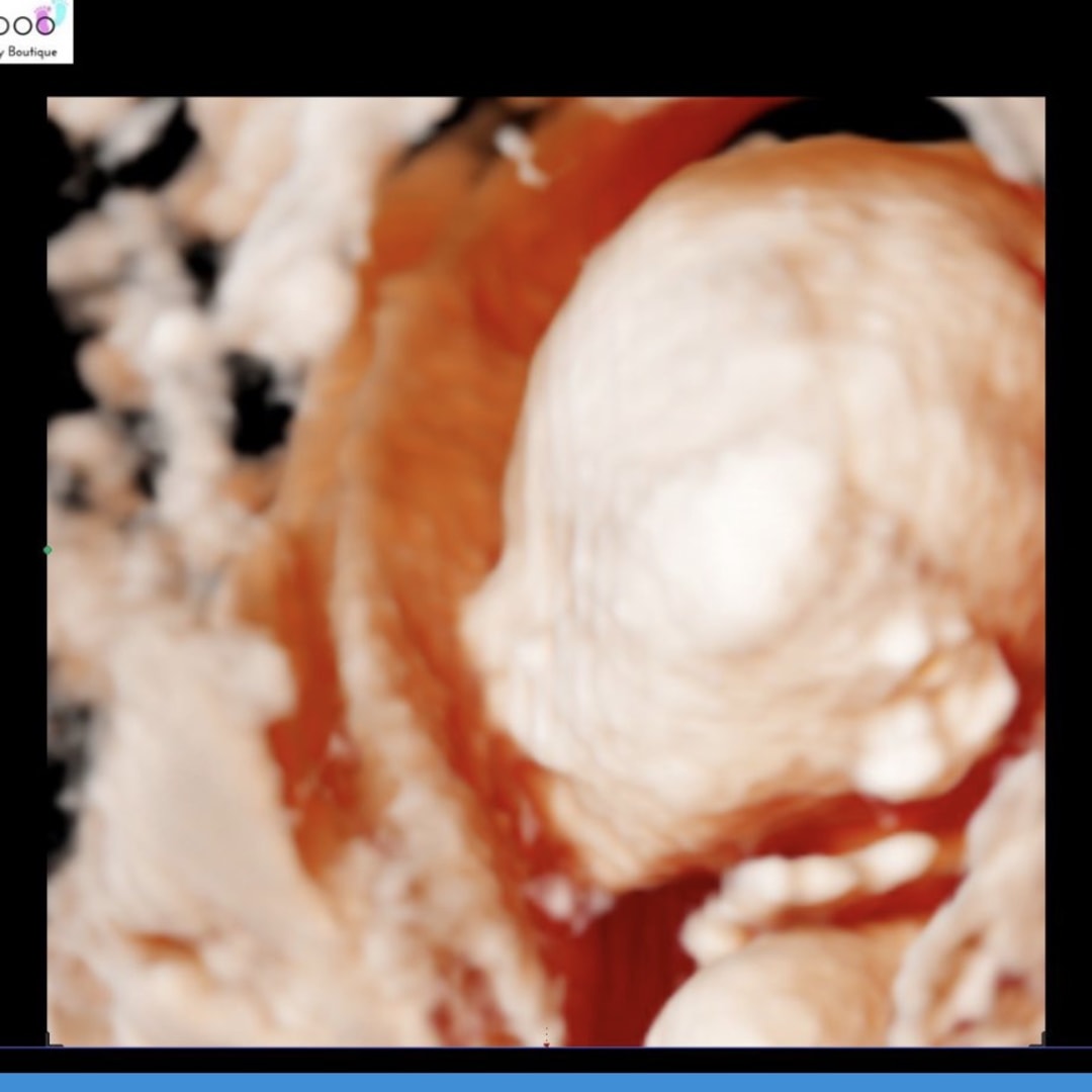 Photo shared by Brittney for their Babylist baby registry.