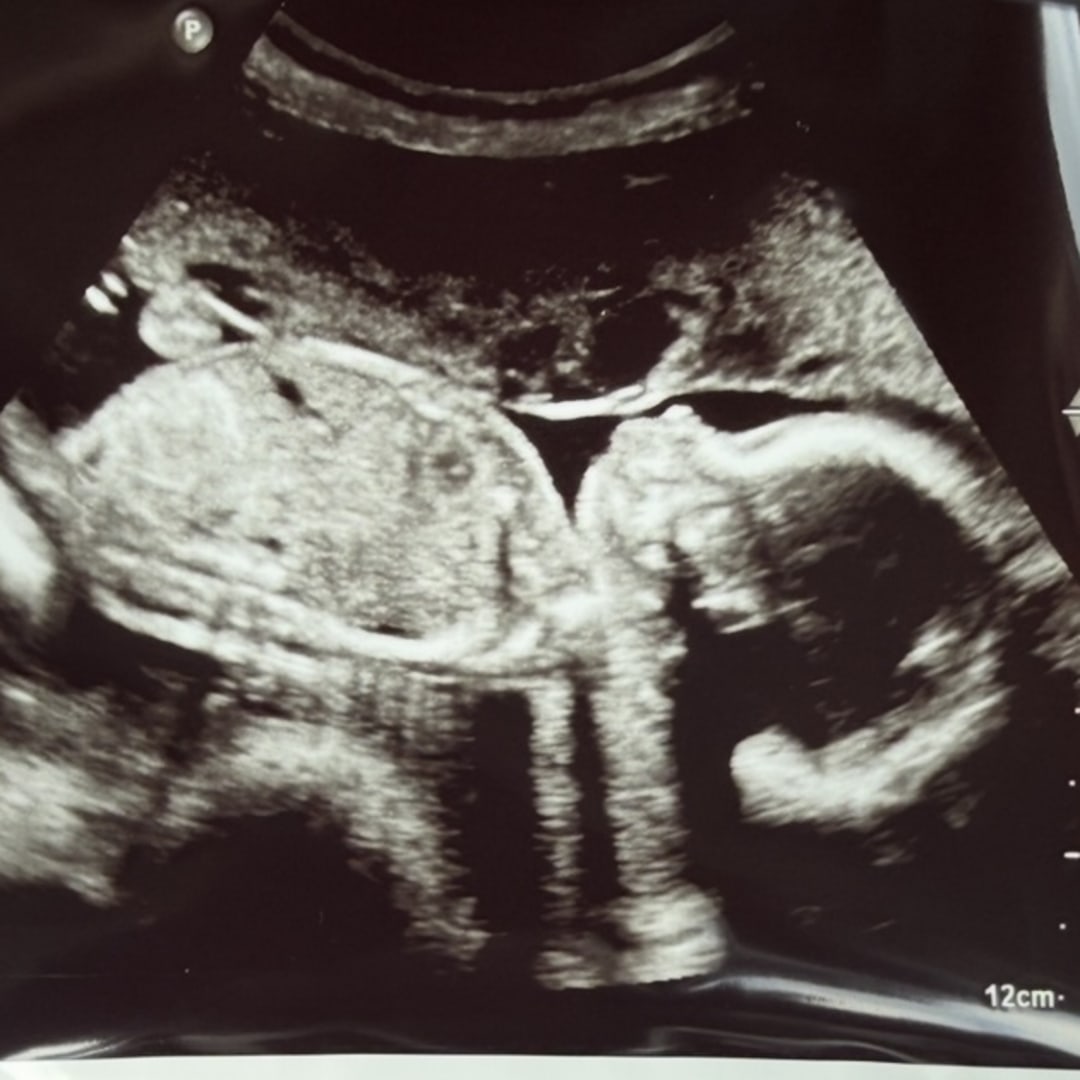 Photo shared by Victoria for their Babylist baby registry.