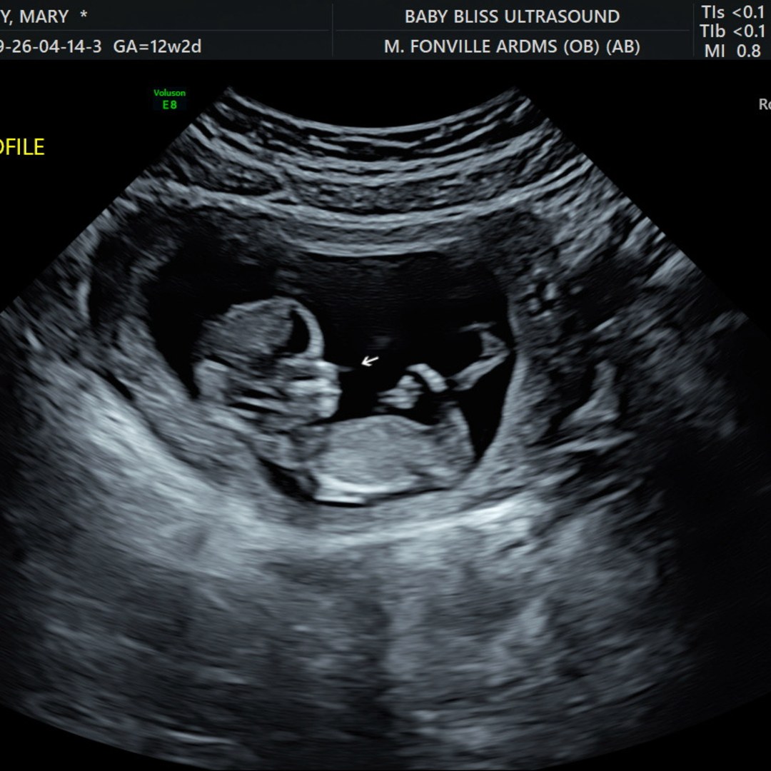 Photo shared by Mary for their Babylist baby registry.