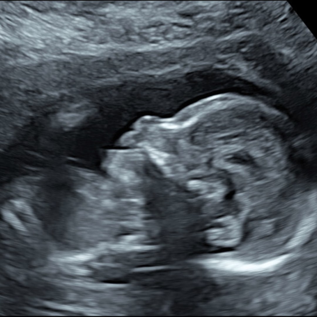 Photo shared by Sarai for their Babylist baby registry.