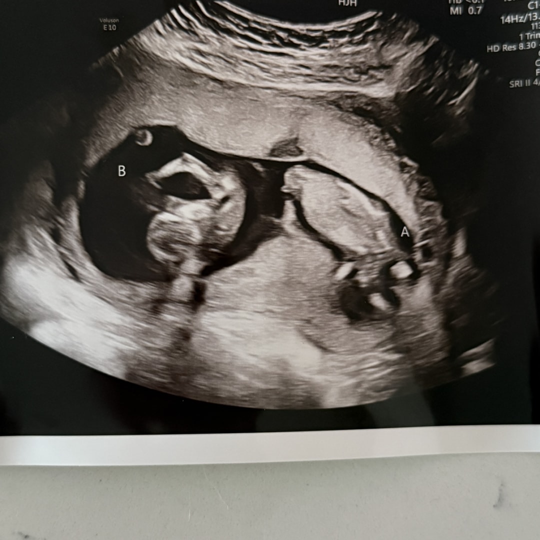 Photo shared by Dominique for their Babylist baby registry.