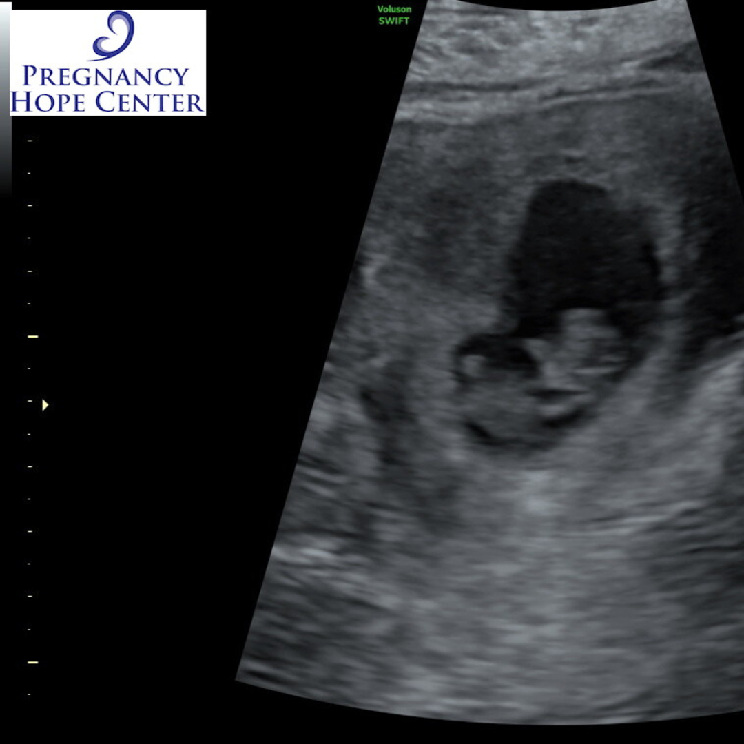 Photo shared by Rebekalyn for their Babylist baby registry.