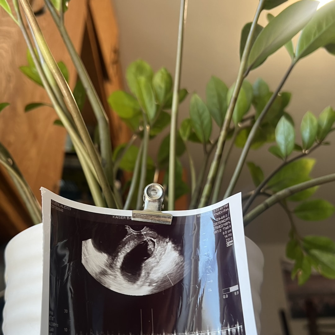 Photo shared by Alexis for their Babylist baby registry.