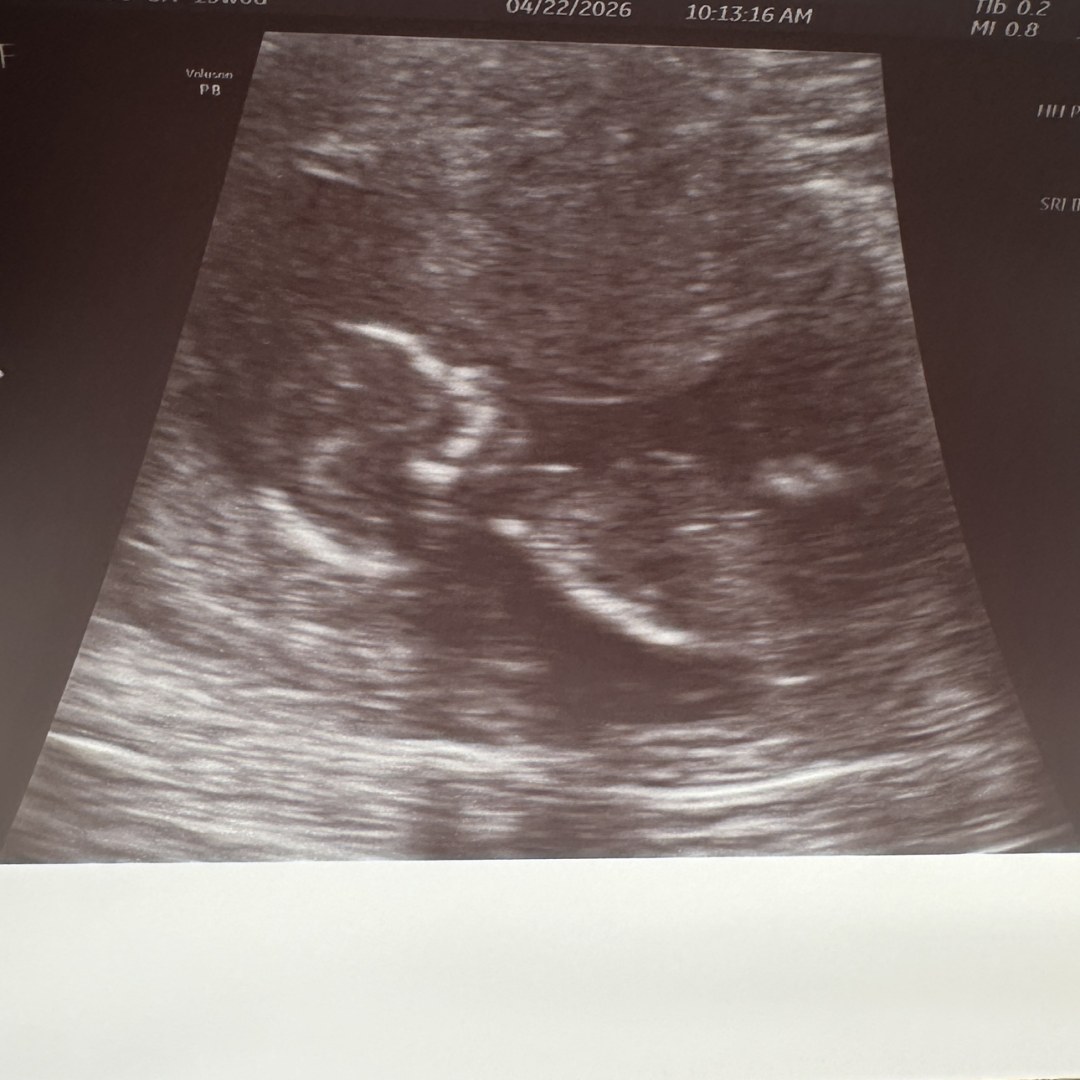 Photo shared by Sara for their Babylist baby registry.