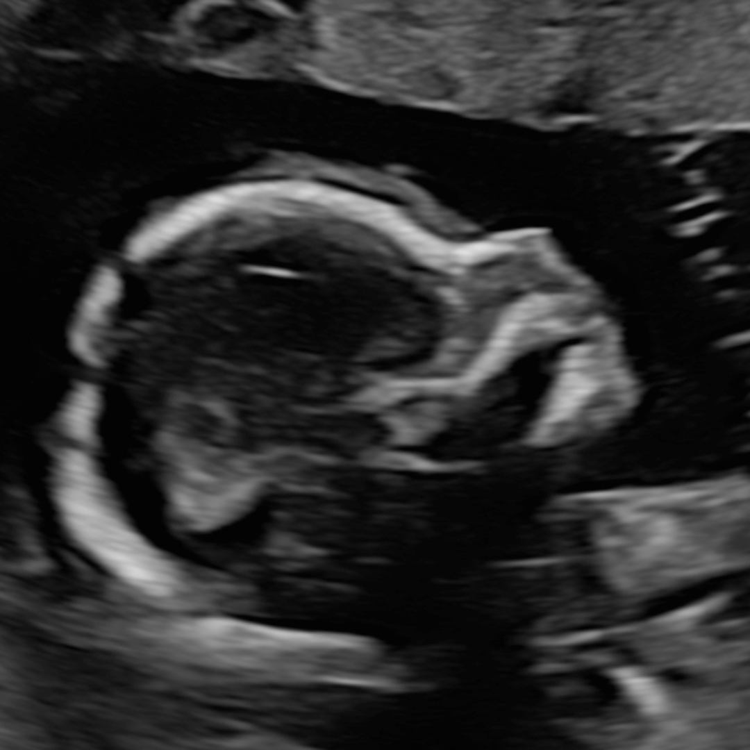 Photo shared by Raeann for their Babylist baby registry.