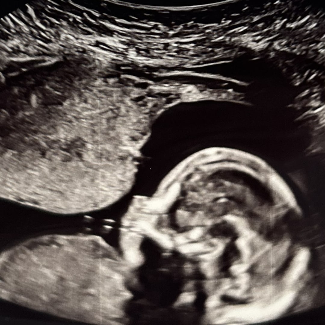 Photo shared by Aimee for their Babylist baby registry.