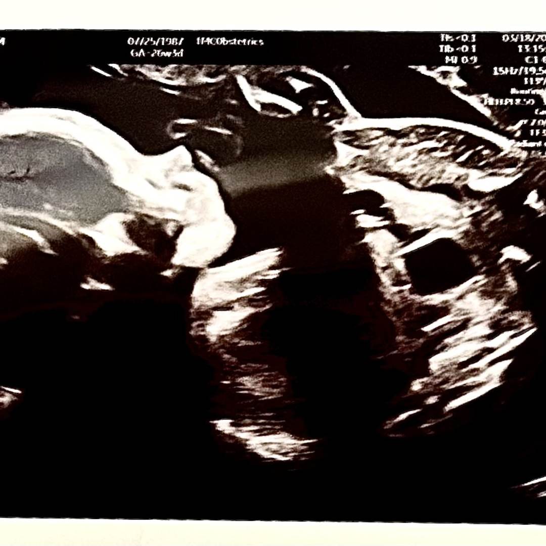 Photo shared by Erin for their Babylist baby registry.