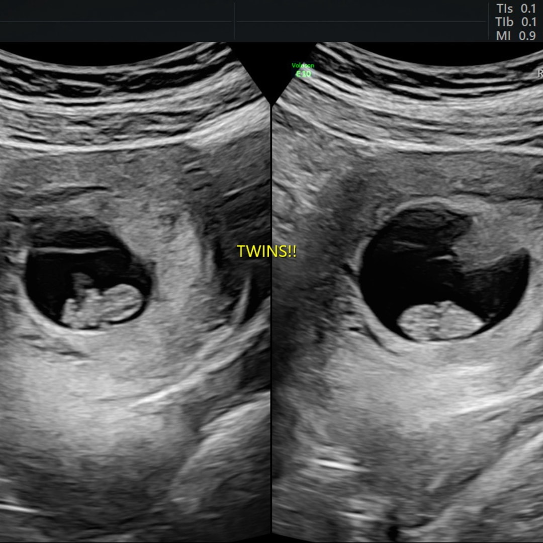 Photo shared by Ashley for their Babylist baby registry.