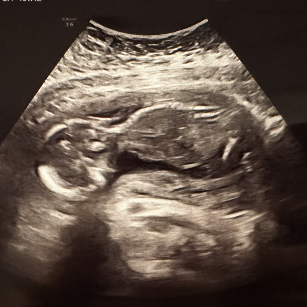 Photo shared by Anna for their Babylist baby registry.