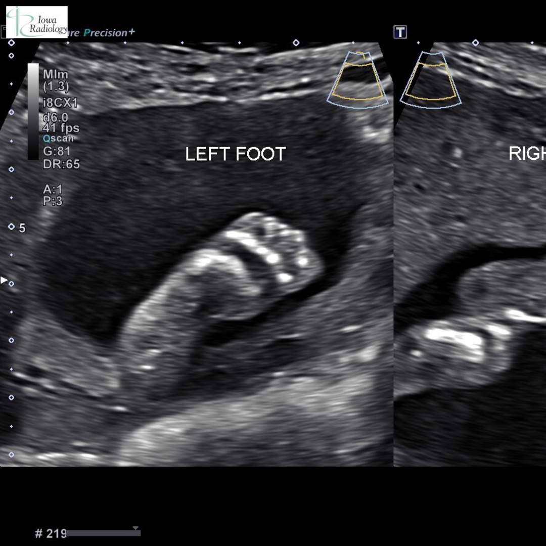 Photo shared by Sarah for their Babylist baby registry.