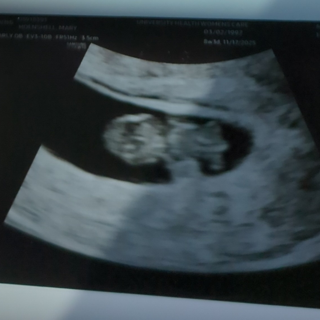 Photo shared by Nikki for their Babylist baby registry.