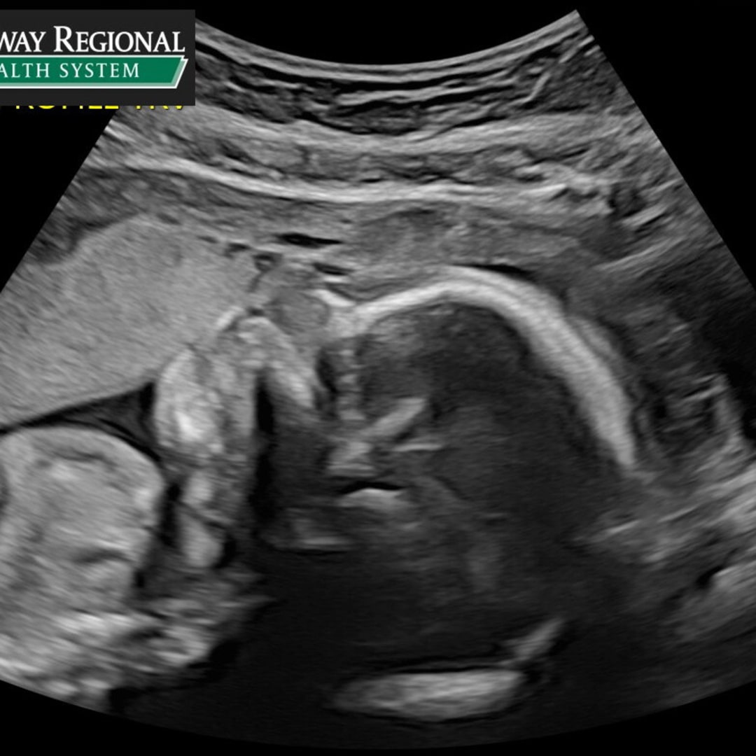 Photo shared by Cathi for their Babylist baby registry.