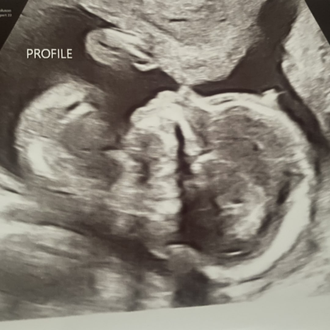 Photo shared by Laura for their Babylist baby registry.