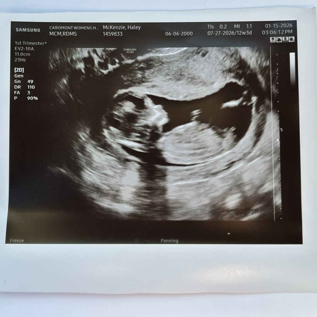 Photo shared by Haley for their Babylist baby registry.