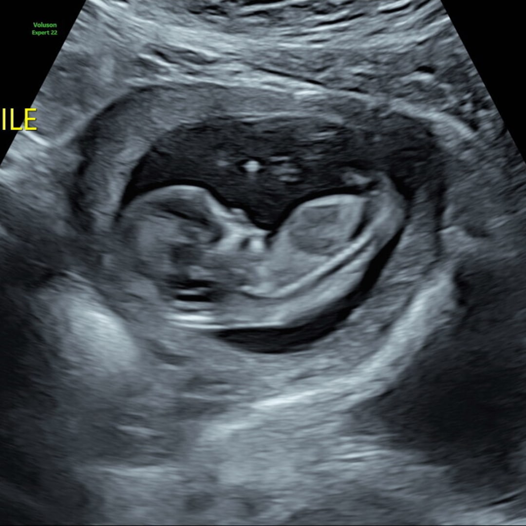 Photo shared by Donna for their Babylist baby registry.