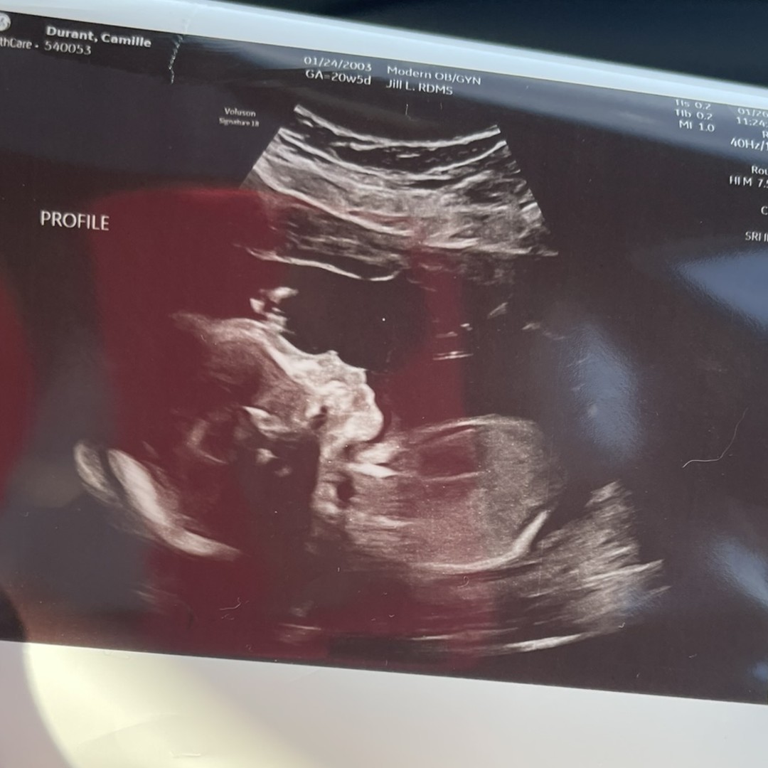 Photo shared by Camille for their Babylist baby registry.