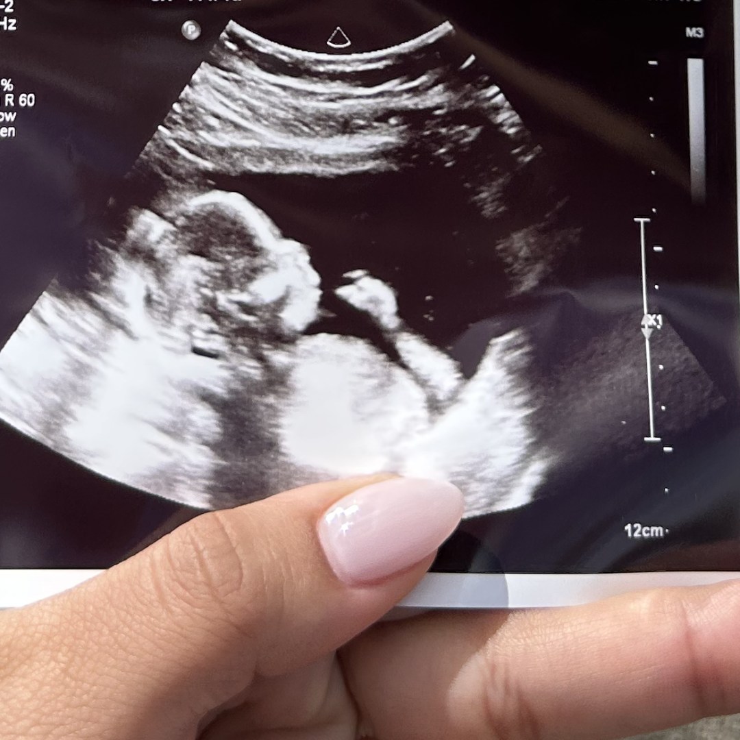 Photo shared by Fabiana for their Babylist baby registry.