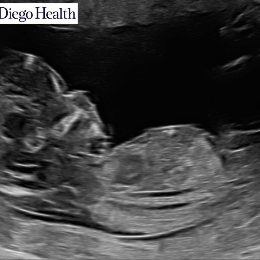 Photo shared by Addie for their Babylist baby registry.