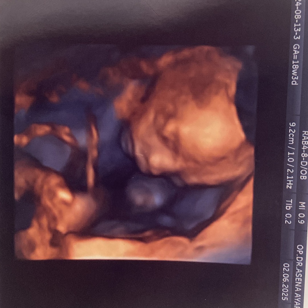 Photo shared by Berna for their Babylist baby registry.