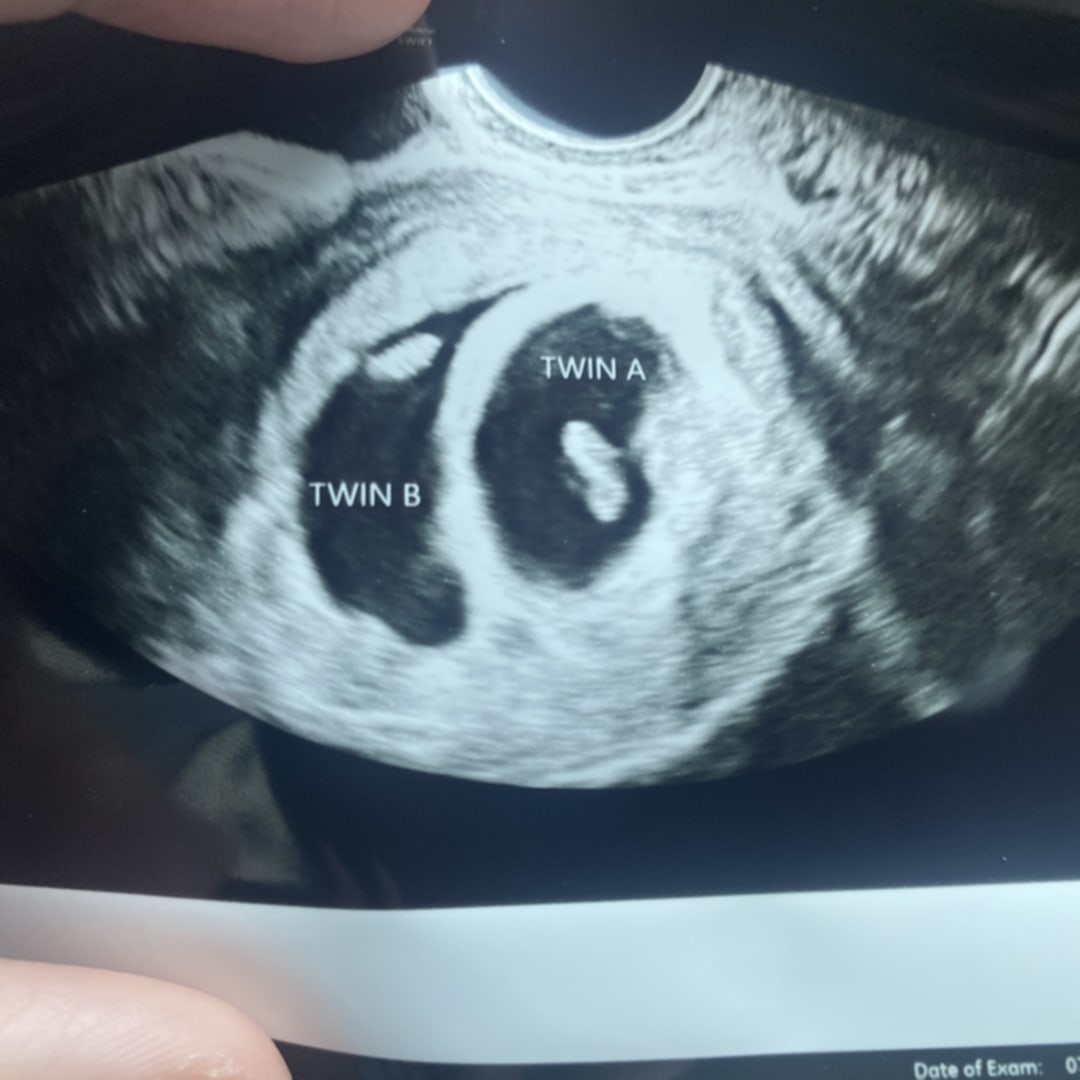 Photo shared by Paige for their Babylist baby registry.
