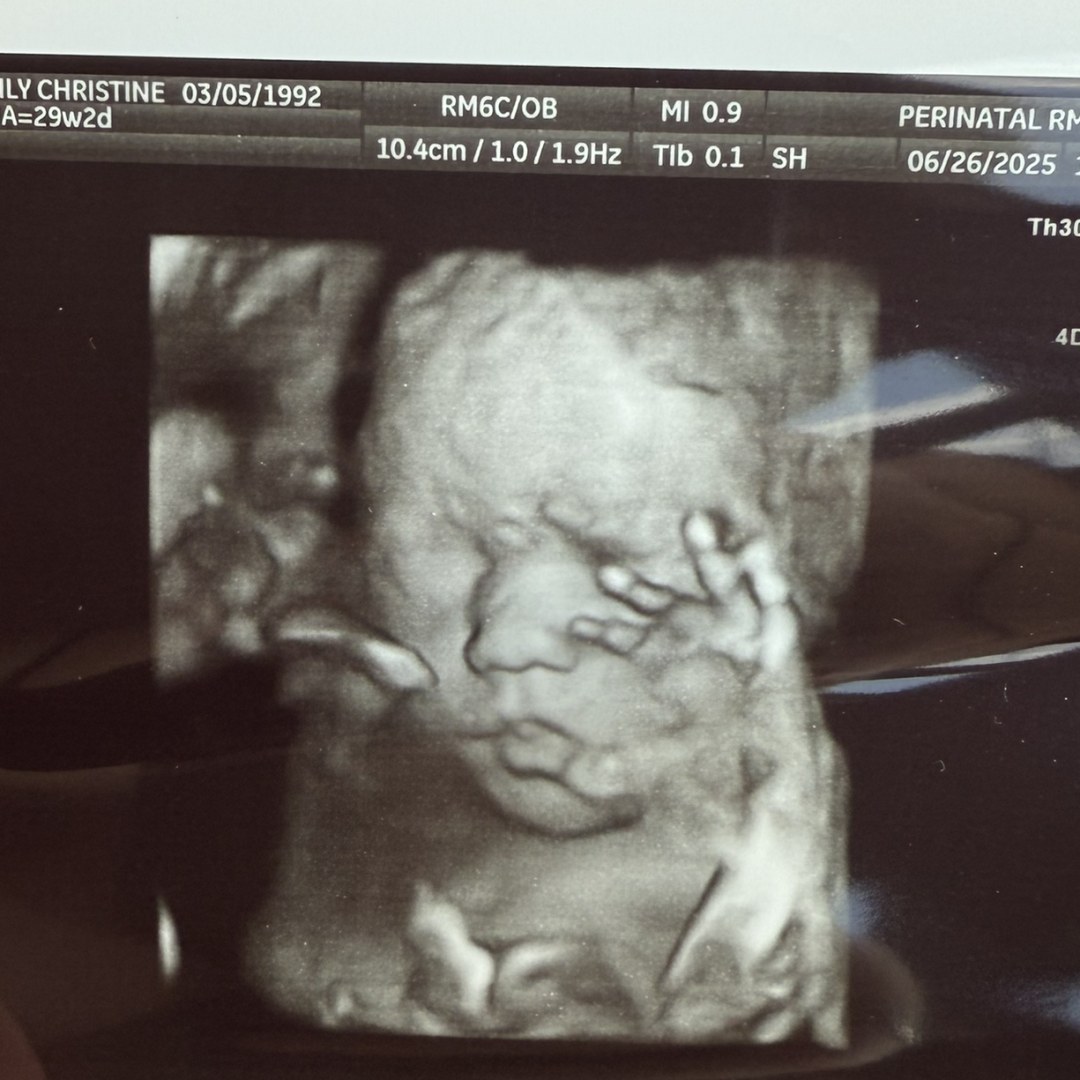 Photo shared by Emily for their Babylist baby registry.