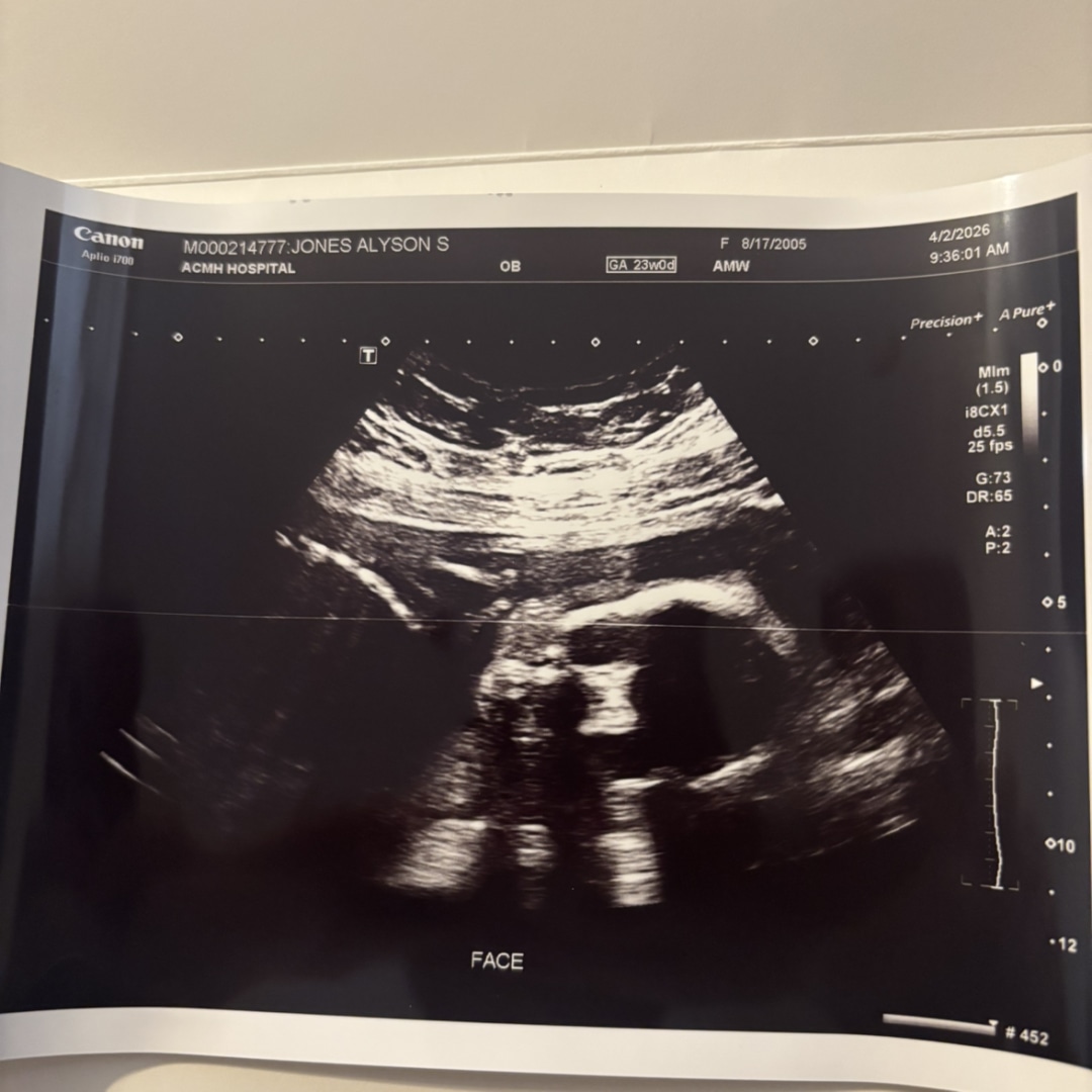 Photo shared by Alyson for their Babylist baby registry.