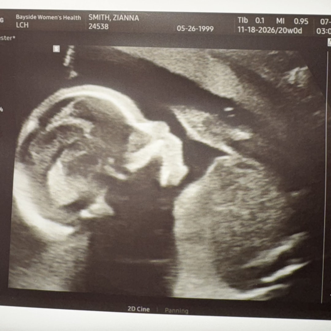 Photo shared by Zianna for their Babylist baby registry.